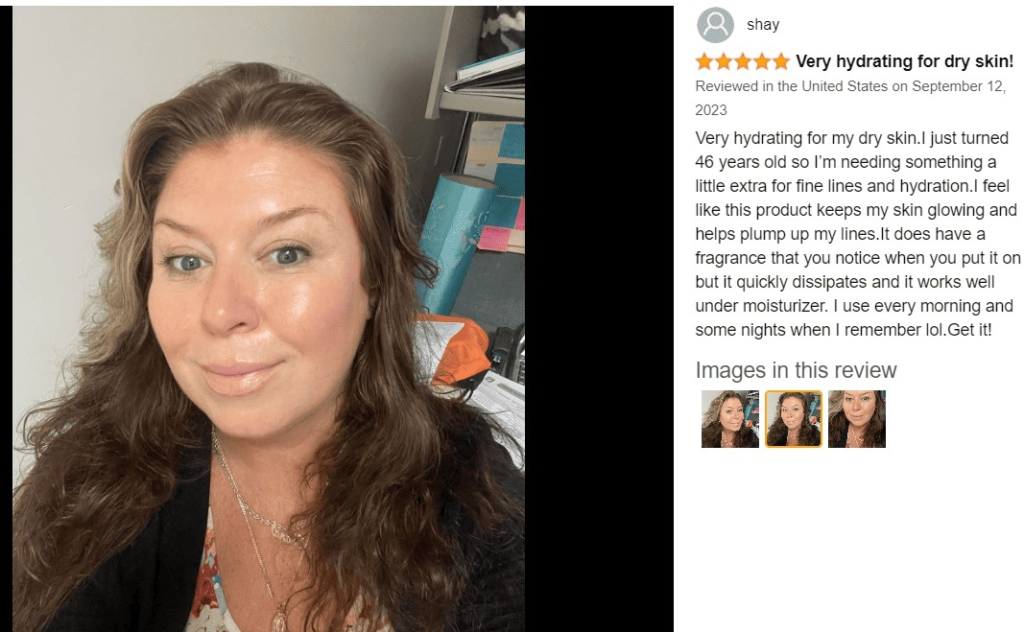 Hyalu B5 Serum Reviews Before and After