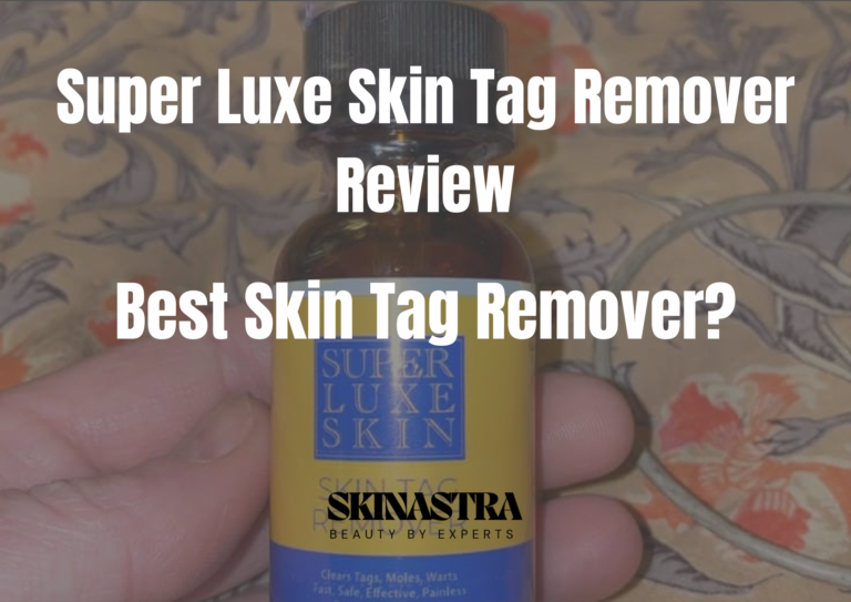 Super Luxe Skin Tag Remover Reviews