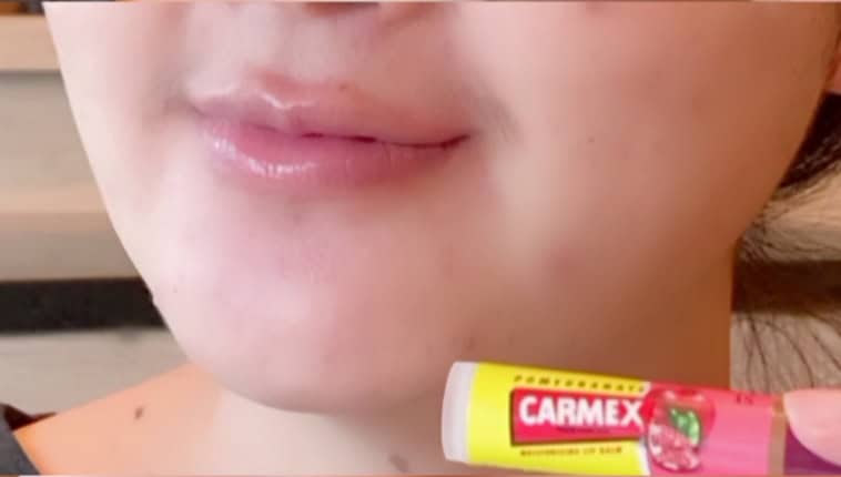 Carmex benefits