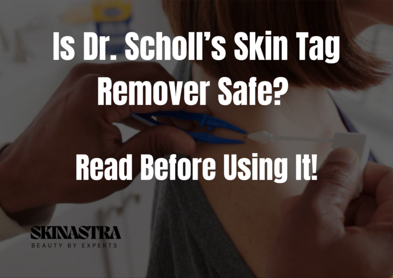 Is Dr. Scholl’s Skin Tag Remover Safe